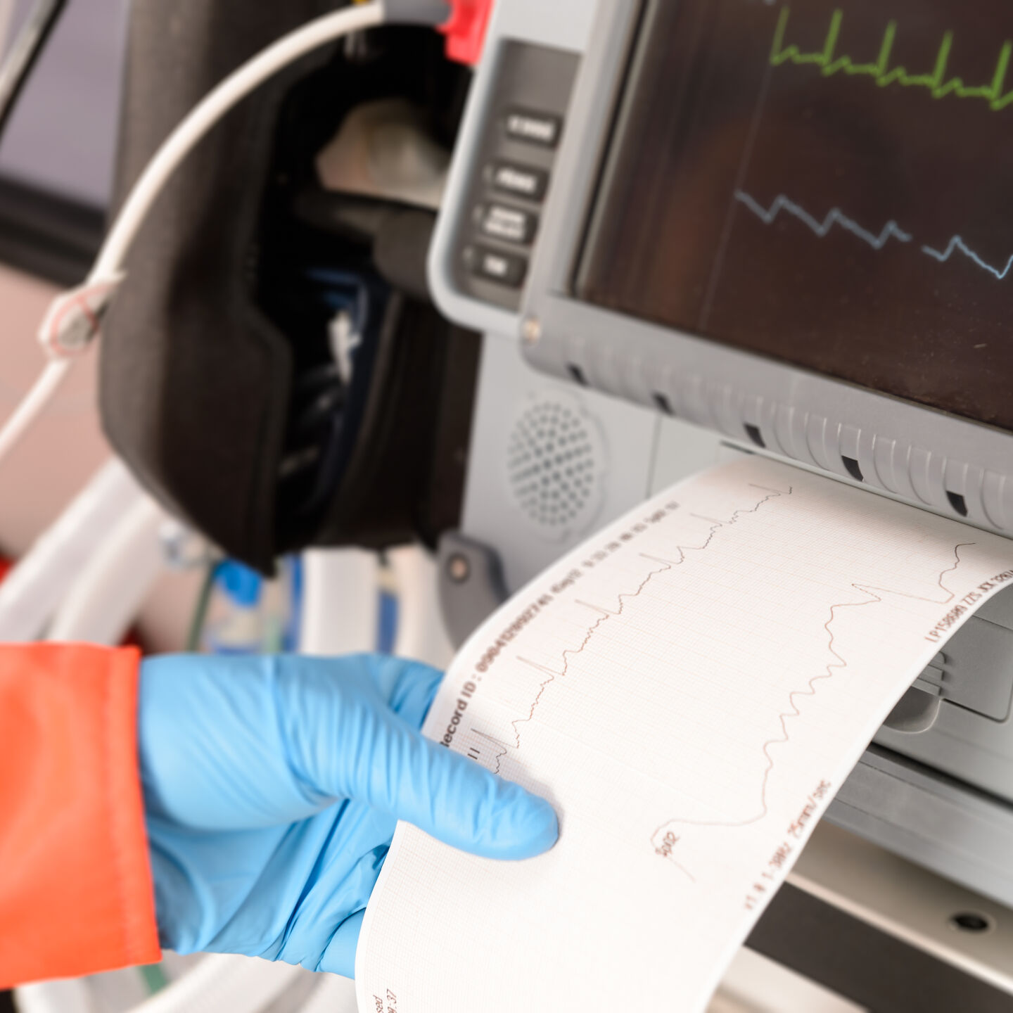 EKG, cardiac, health